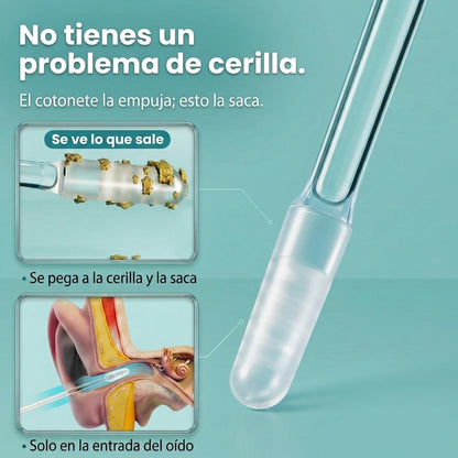 No tienes un problema de cerilla: el cotonete la empuja, Cero Cera la saca